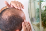 6 Best Fixes for Fighting Hair Loss and Winning |